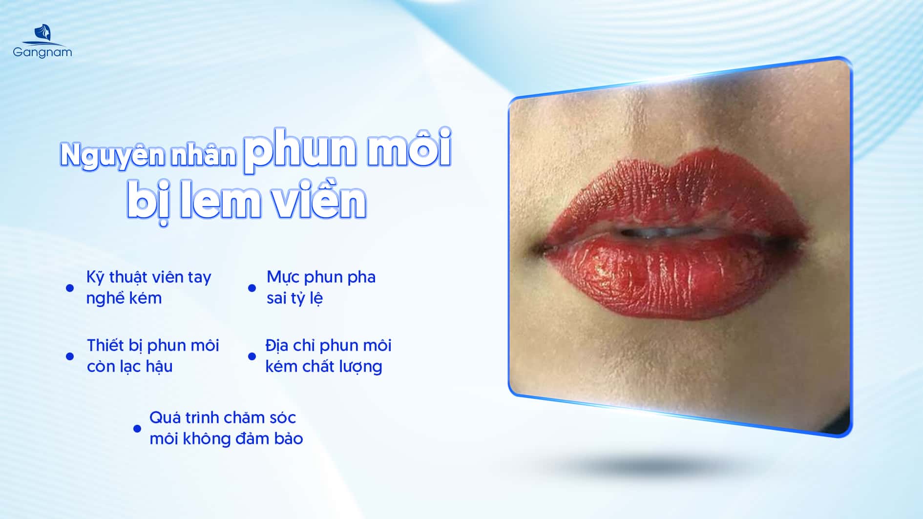 Phun môi bị lem viền - Nguyên nhân và cách khắc phục hiệu quả 6 Phun môi bị lem viền