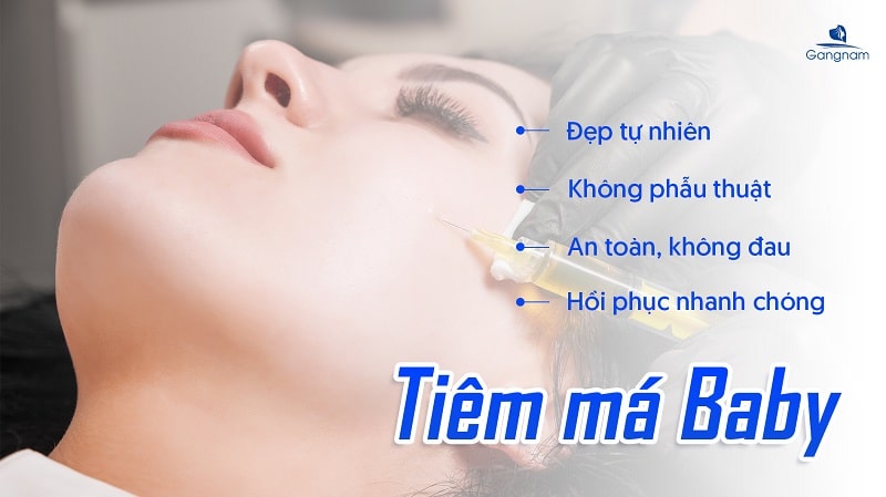 Tiêm má Baby bao nhiêu tiền? 6 Tiêm má Baby bao nhiêu tiền?