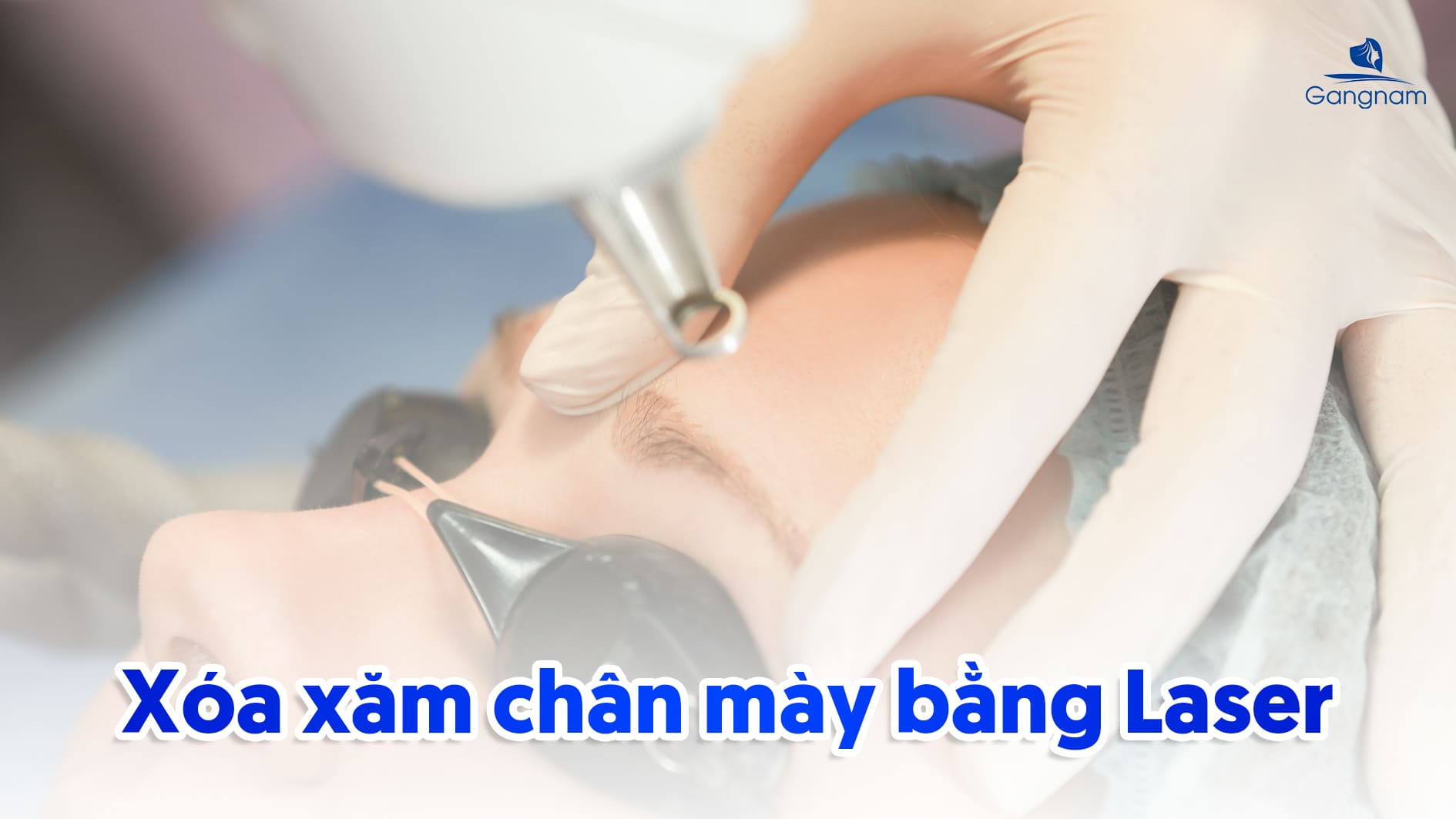 Xóa xăm lông mày giá bao nhiêu? 5 Xóa xăm lông mày giá bao nhiêu?