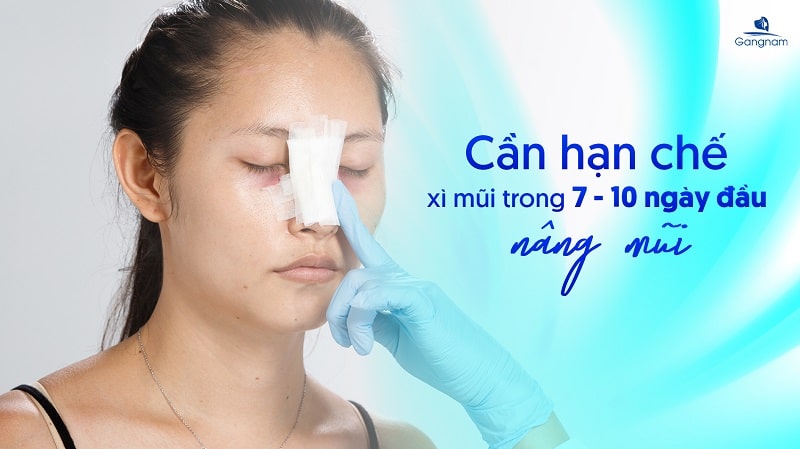 Nâng mũi bao lâu thì được xì mũi? 5 Nâng mũi bao lâu thì được xì mũi?