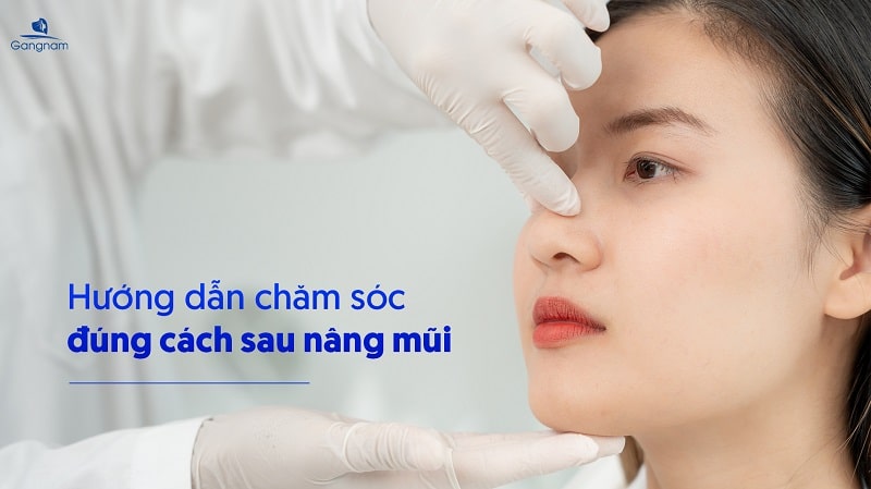 Nâng mũi bao lâu thì được xì mũi? 6 Nâng mũi bao lâu thì được xì mũi?