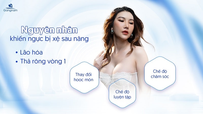 Nâng ngực xong có bị xệ không? 6 Nâng ngực xong có bị xệ không?