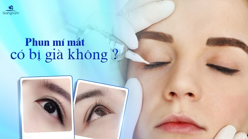 Phun mí mắt có bị già không? 5 Phun mí mắt có bị già không?