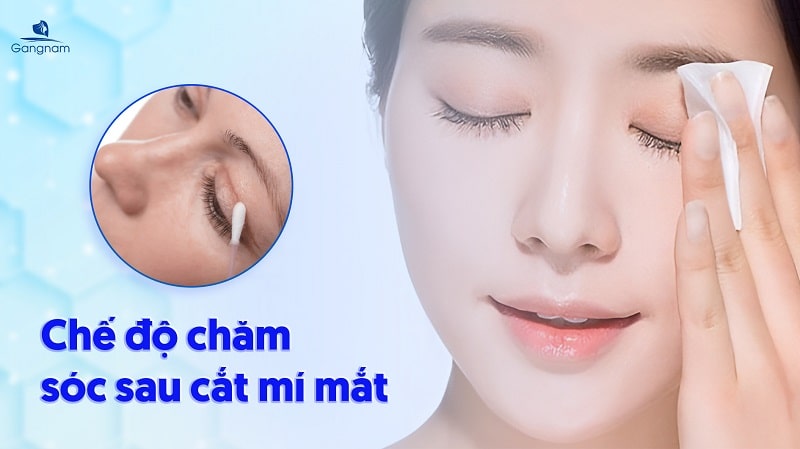 Cắt mí kiêng rượu bia bao lâu? 6 Cắt mí kiêng rượu bia bao lâu?