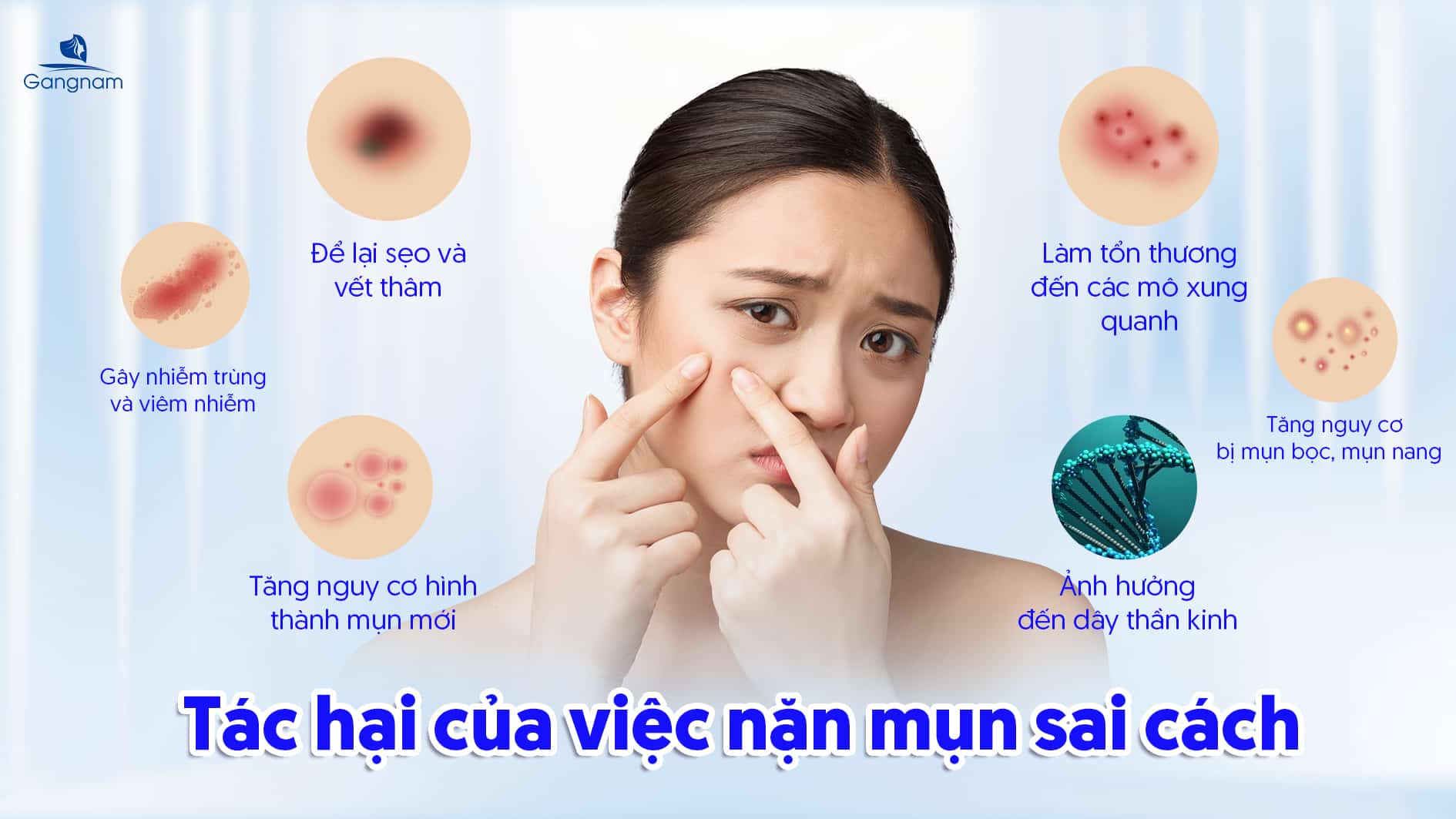 Có nên nặn mụn không? 5 Có nên nặn mụn không?