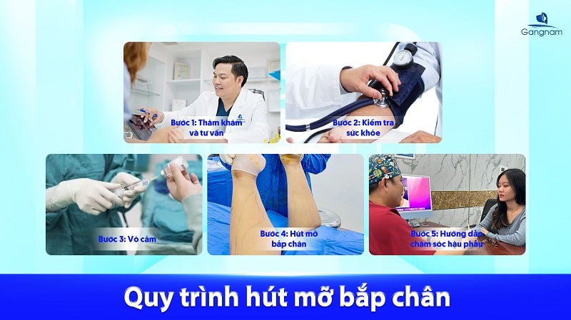Có nên hút mỡ bắp chân không? 7 Hút mỡ bắp chân