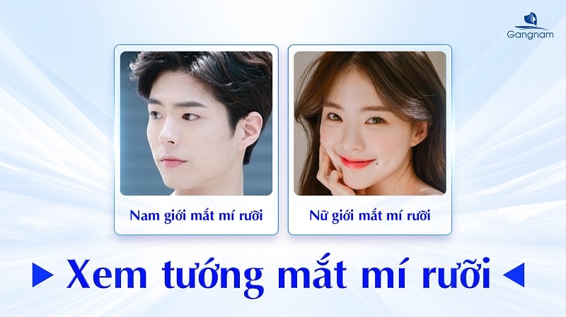 Mắt mí rưỡi là gì? Nguyên nhân và cách khắc phục hiệu quả 7 Mắt mí rưỡi