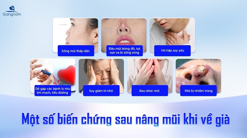 Nâng mũi về già có sao không? 5 Nâng mũi về già có sao không?