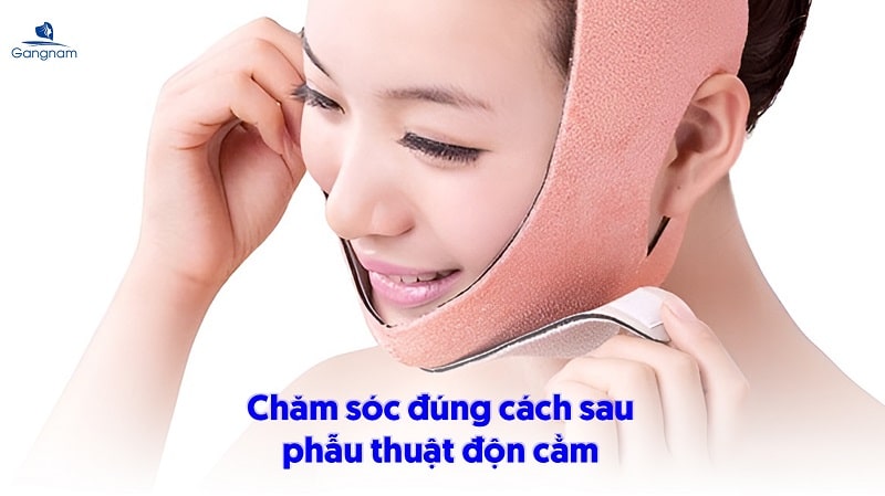 Độn cằm sụn tự thân có tốt không? 7 Độn cằm sụn tự thân