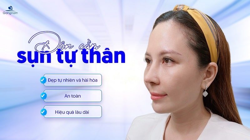 Độn cằm sụn tự thân có tốt không? 6 Độn cằm sụn tự thân