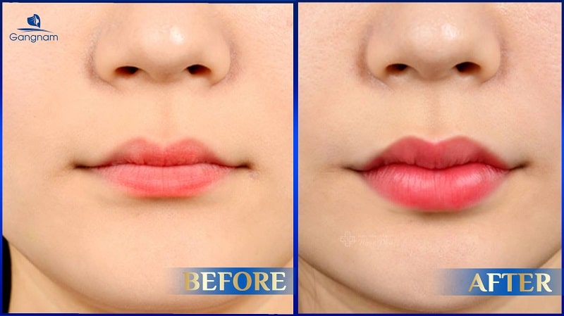 Môi mỏng là gì? Môi mỏng đẹp hay xấu? 8 Môi mỏng là gì?