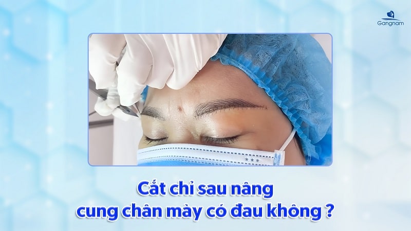 Nâng cung mày mấy ngày cắt chỉ? 7 Nâng cung mày mấy ngày cắt chỉ?