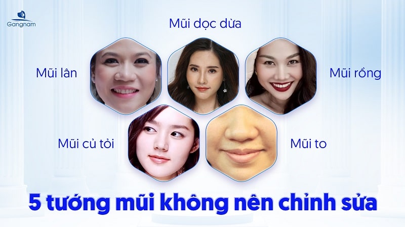 Tìm hiểu những dáng mũi không nên sửa 5 Những dáng mũi không nên sửa