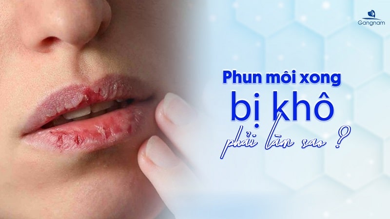 Phun môi xong bị khô phải làm sao? 4 Phun môi xong bị khô