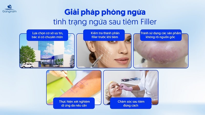 Tiêm Filler xong bị ngứa có sao không? 7 Tiêm Filler xong bị ngứa