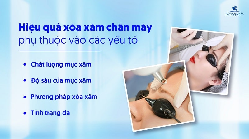 Xóa xăm chân mày có hết không? 5 Xóa xăm chân mày có hết không?