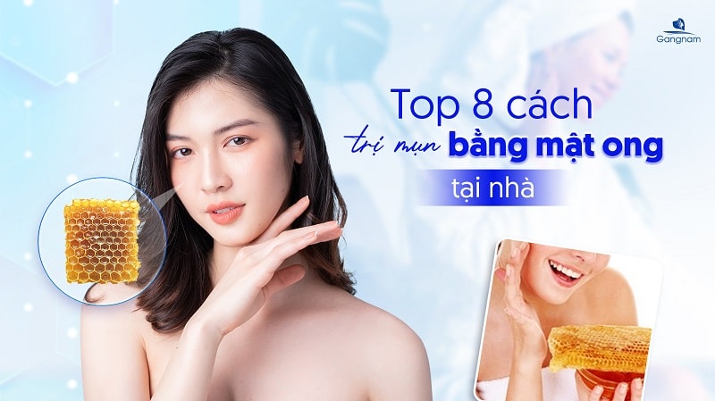 Top 8 cách trị mụn bằng mật ong tại nhà 5 Cách trị mụn bằng mật ong