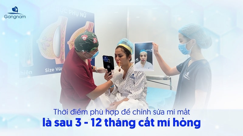 Cắt mí bên to bên nhỏ phải làm sao? 7 Cắt mí bên to bên nhỏ