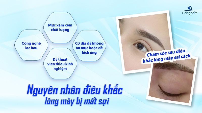 Điêu khắc lông mày bị mất sợi - Nguyên nhân và cách khắc phục 5 Điêu khắc lông mày bị mất sợi