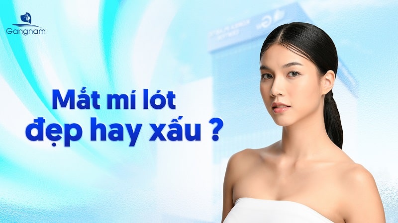 Mắt mí lót đẹp hay xấu? Cách khắc phục hiệu quả 5 Mắt mí lót
