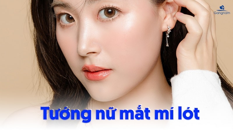 Mắt mí lót đẹp hay xấu? Cách khắc phục hiệu quả 7 Mắt mí lót