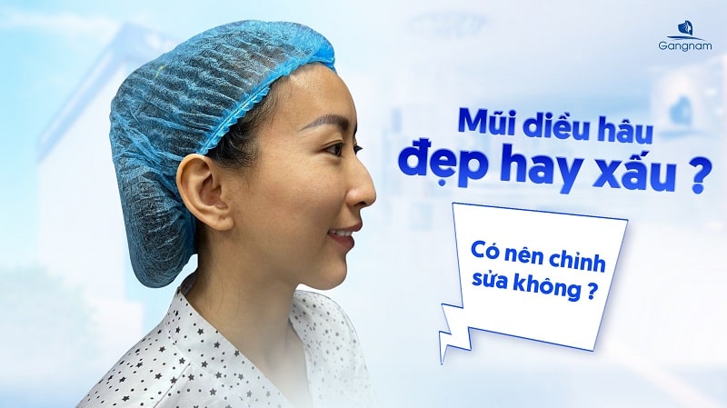 Mũi diều hâu là gì? Đẹp hay xấu? Có nên chỉnh sửa không? 4 Mũi diều hâu là gì?