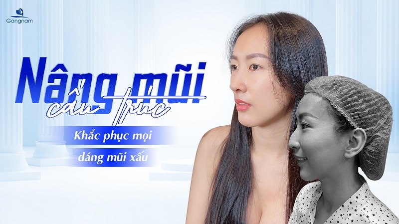 Mũi diều hâu là gì? Đẹp hay xấu? Có nên chỉnh sửa không? 6 Mũi diều hâu là gì?