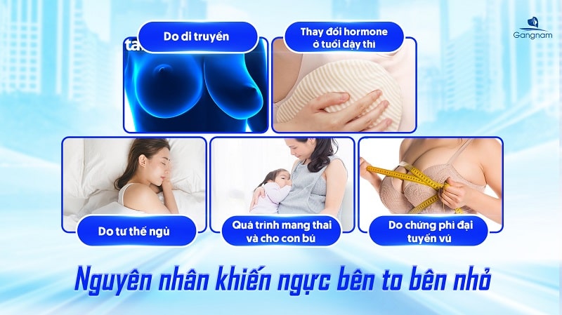 Ngực bên to bên nhỏ - Nguyên nhân và cách khắc phục 6 Ngực bên to bên nhỏ