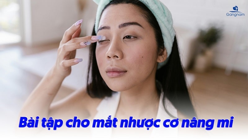 Nhược cơ nâng mi là gì? Nguyên nhân và cách khắc phục hiệu quả 7 Nhược cơ nâng mi