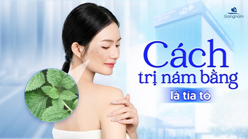 Cách trị nám bằng lá tía tô tại nhà đơn giản nhưng hiệu quả 5 Trị nám bằng lá tía tô