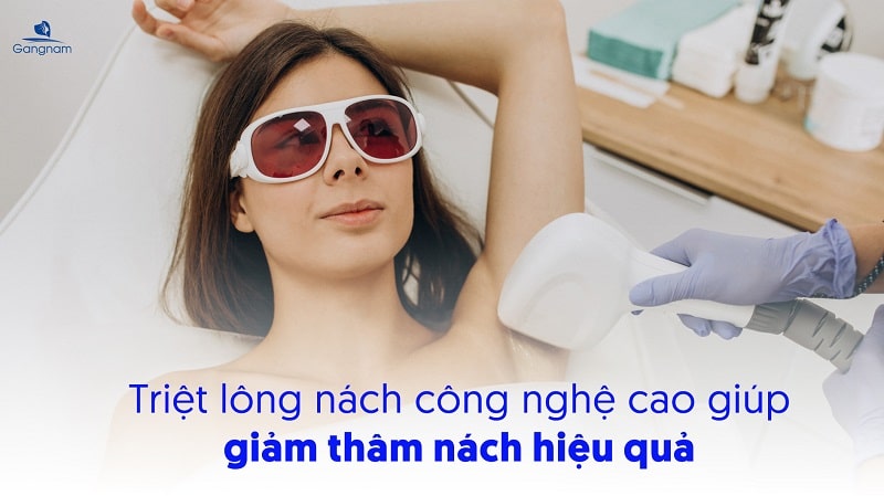Triệt lông nách có hết thâm không? 5 Triệt lông nách có hết thâm không?