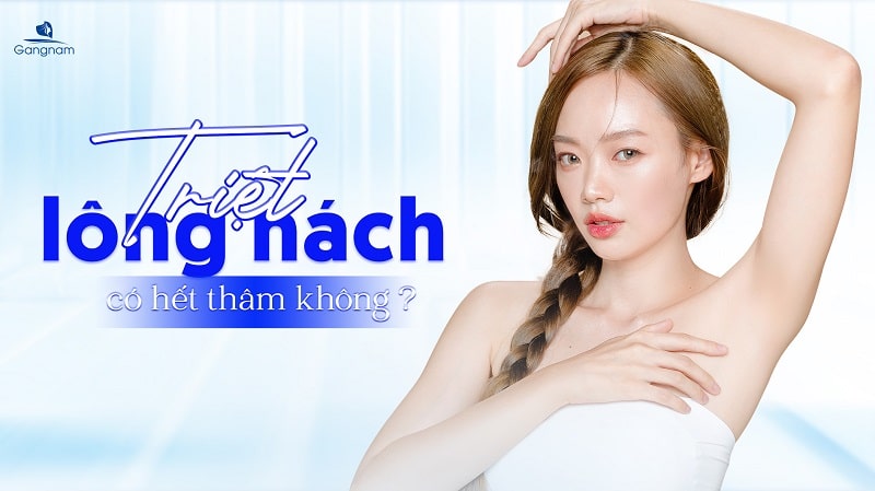 Triệt lông nách có hết thâm không? 4 Triệt lông nách có hết thâm không?