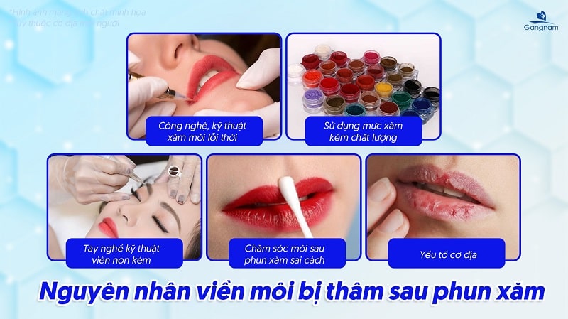 Viền môi bị thâm sau khi xăm phải làm sao? 5 Viền môi bị thâm sau khi xăm