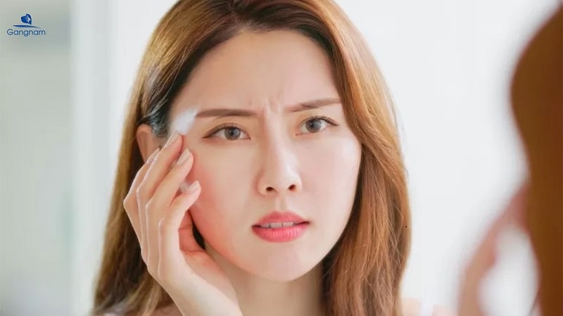 Xóa cơ cau mày - Bí quyết lấy lại gương mặt tươi trẻ 6 Xóa cơ cau mày