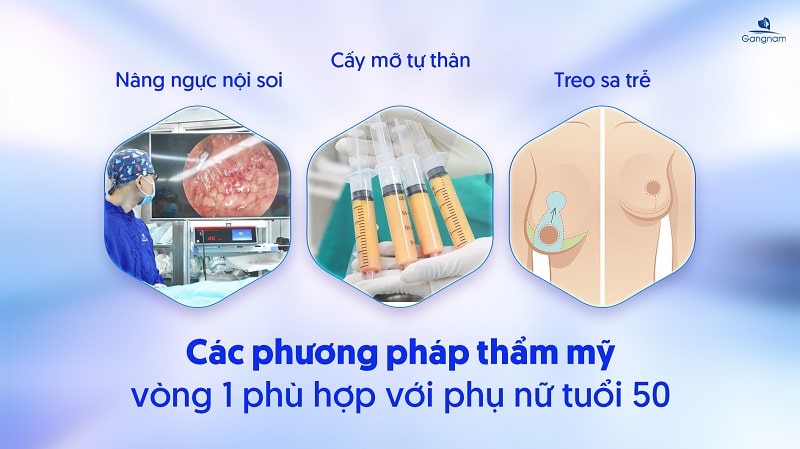 50 tuổi có nên nâng ngực không? 5 50 tuổi có nên nâng ngực không?