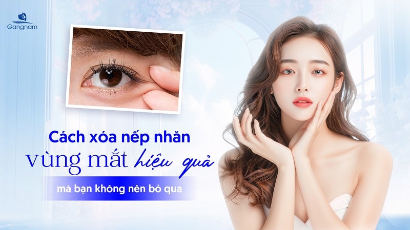 Cách xóa nếp nhăn vùng mắt hiệu quả 5 Cách xóa nếp nhăn vùng mắt