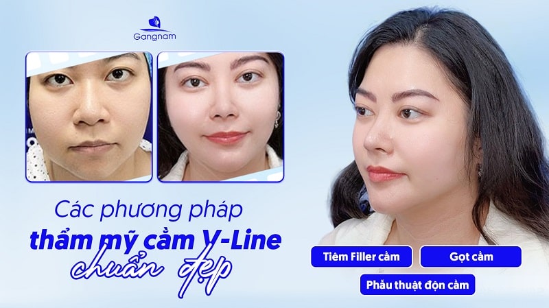 Cằm nhọn đẹp hay xấu? Có ý nghĩa tướng số như thế nào? 7 Cằm nhọn là gì?