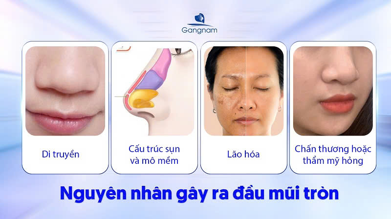 Đầu mũi tròn - Đặc điểm nhận biết và cách khắc phục 6 Đầu mũi tròn