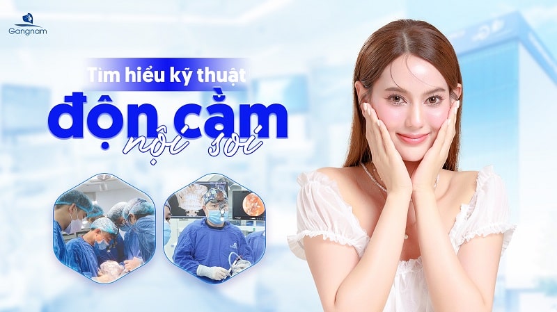 Độn cằm nội soi - Công nghệ tạo cằm VLine an toàn, hiệu quả cao 5 Độn cằm nội soi
