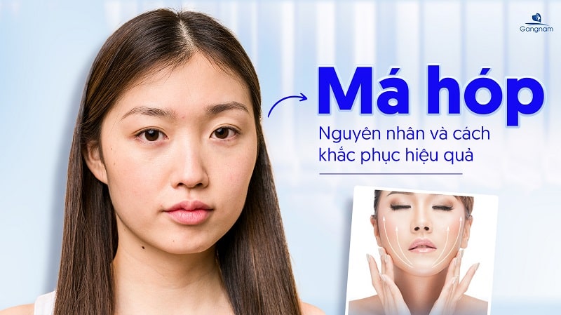 Má hóp là gì? Nguyên nhân và cách khắc phục hiệu quả 5 Má hóp là gì?