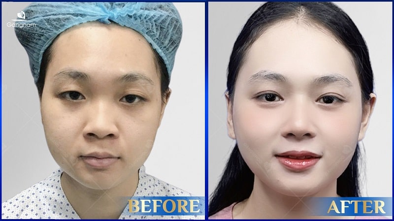 Mắt biếc là gì? Ý nghĩa của đôi mắt biếc 8 Mắt biếc là gì?