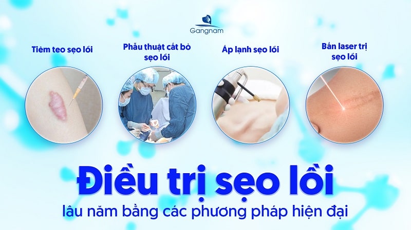 Sẹo lồi lâu năm có trị được không? 7 Sẹo lồi lâu năm có trị được không?
