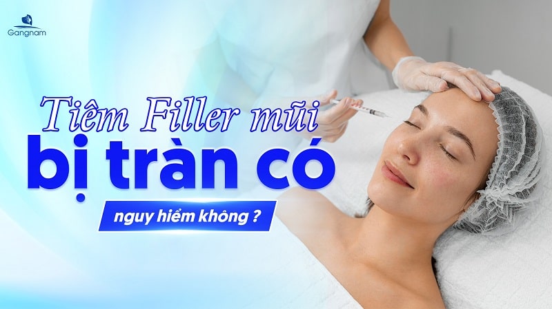 Tiêm Filler mũi bị tràn có nguy hiểm không? 4 Tiêm Filler mũi bị tràn