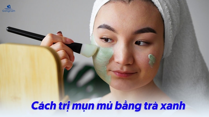 Cách trị mụn mủ tại nhà bằng các nguyên liệu tự nhiên 7 Cách trị mụn mủ