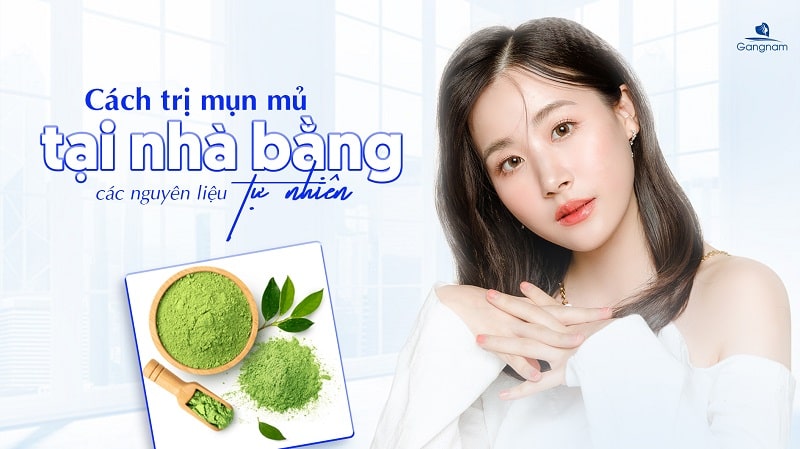 Cách trị mụn mủ tại nhà bằng các nguyên liệu tự nhiên 5 Cách trị mụn mủ