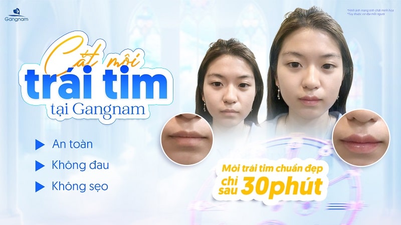 Có nên cắt môi trái tim không? 6 Có nên cắt môi trái tim không?