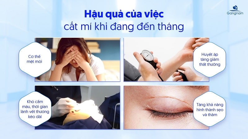 Phụ nữ đến tháng có cắt mí được không? 5 Đến tháng có cắt mí được không?