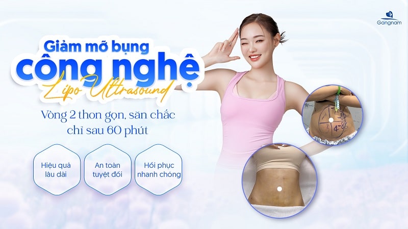 Hút mỡ bụng bị lồi lõm - Nguyên nhân và cách khắc phục 6 Hút mỡ bụng bị lồi lõm