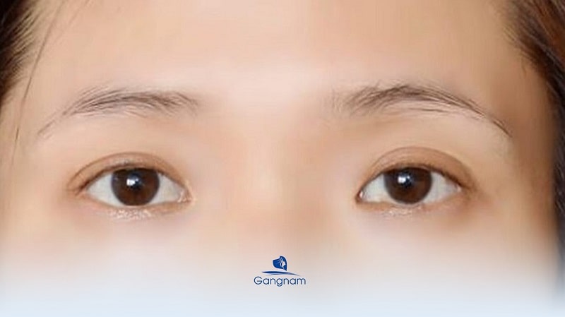 Lông mày ngắn có tướng số tốt hay xấu? 6 Lông mày ngắn