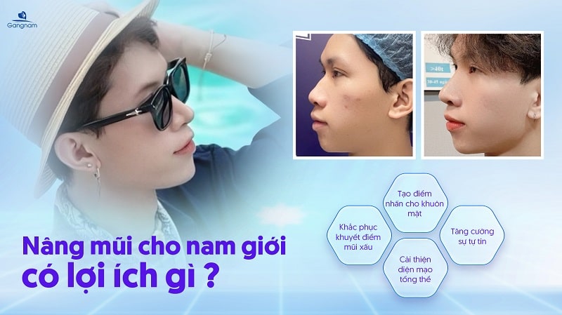 Nam giới có nên nâng mũi không? 5 Nam giới có nên nâng mũi không?